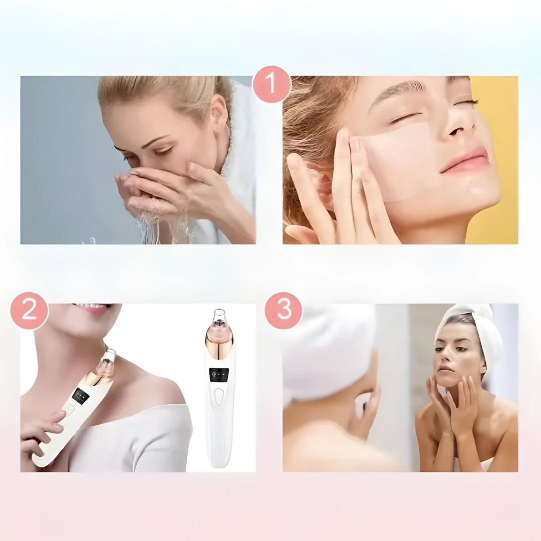 Aspy - Aspiratore Punti Neri 3 in 1